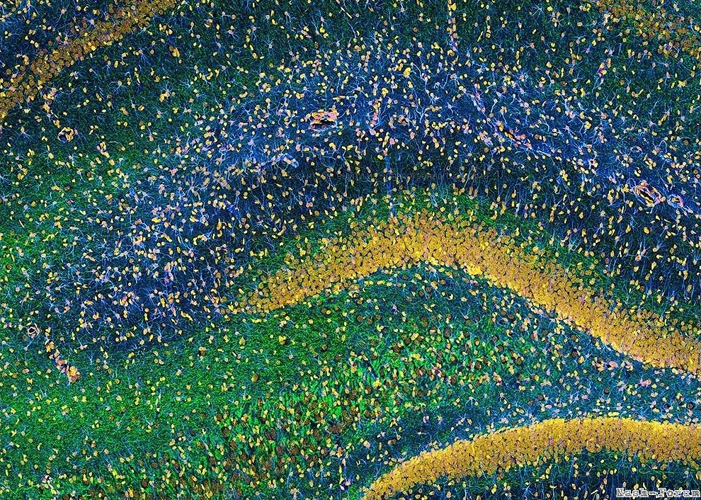 . Мозг крысы. Часть мозга - гипокамп. Синим подсвечены глиальные клетки, зеленым нейрофиламенты, жел